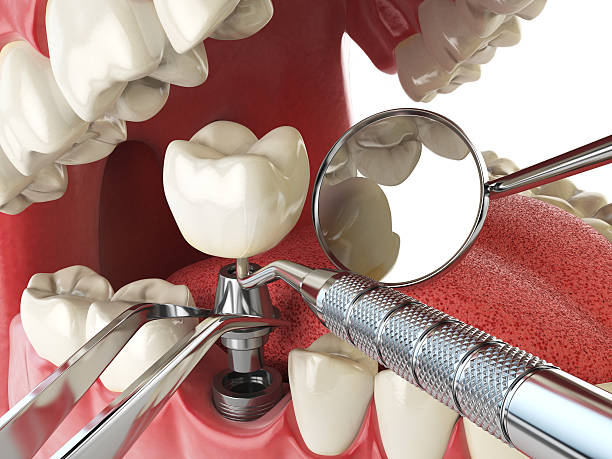 Trusted IL Emergency Dental Service Experts